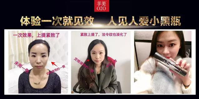 鄭州美博會_因V不凡，小黑瓶的魅力無法阻擋。